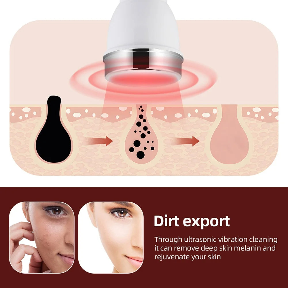 Ultrasound Skin Care Beauty Machine High Frequency Face Eye Massager SPA Ultrasonic Beauty Device
