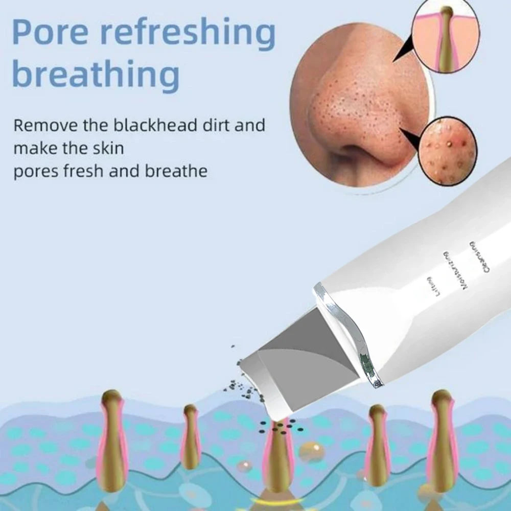 Ultrasonic Skin Scraper Pore Cleaning Facial Deep Cleaning