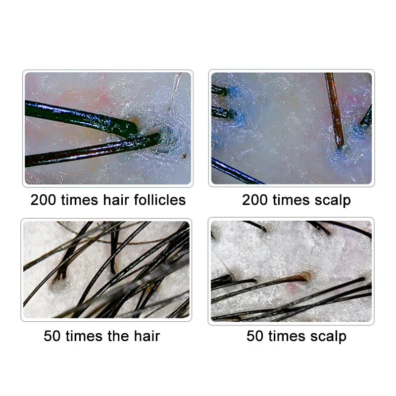 Professional use Digital Skin Analyzer 2025 HD Professional Hair Scalp Camera Detector Hair Follicle Oil Moisture Test Device 10inch 50/200X