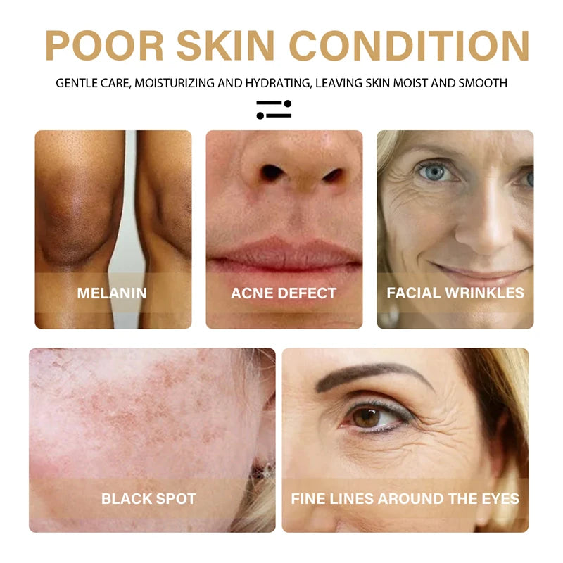 Turmeric Face Serum Shrink Pore Repair Melanin Dark Spot