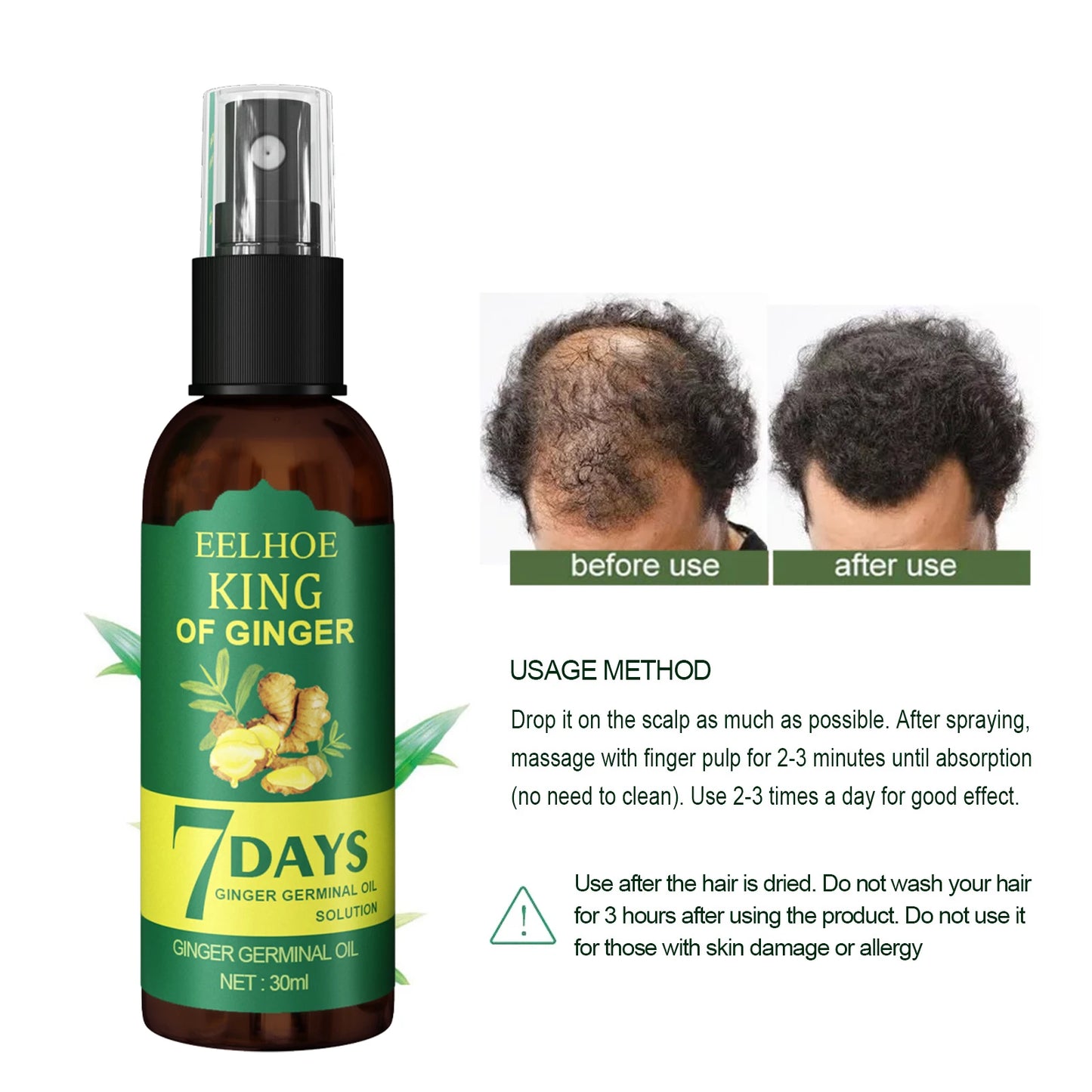 Ginger Care Hair Spray Hair Growth