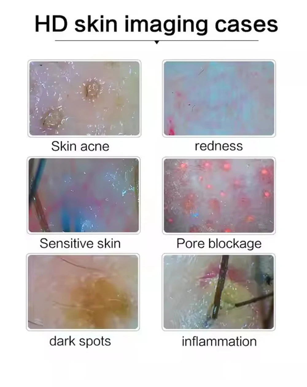 Professional use Digital Skin Analyzer 2025 HD Professional Hair Scalp Camera Detector Hair Follicle Oil Moisture Test Device 10inch 50/200X