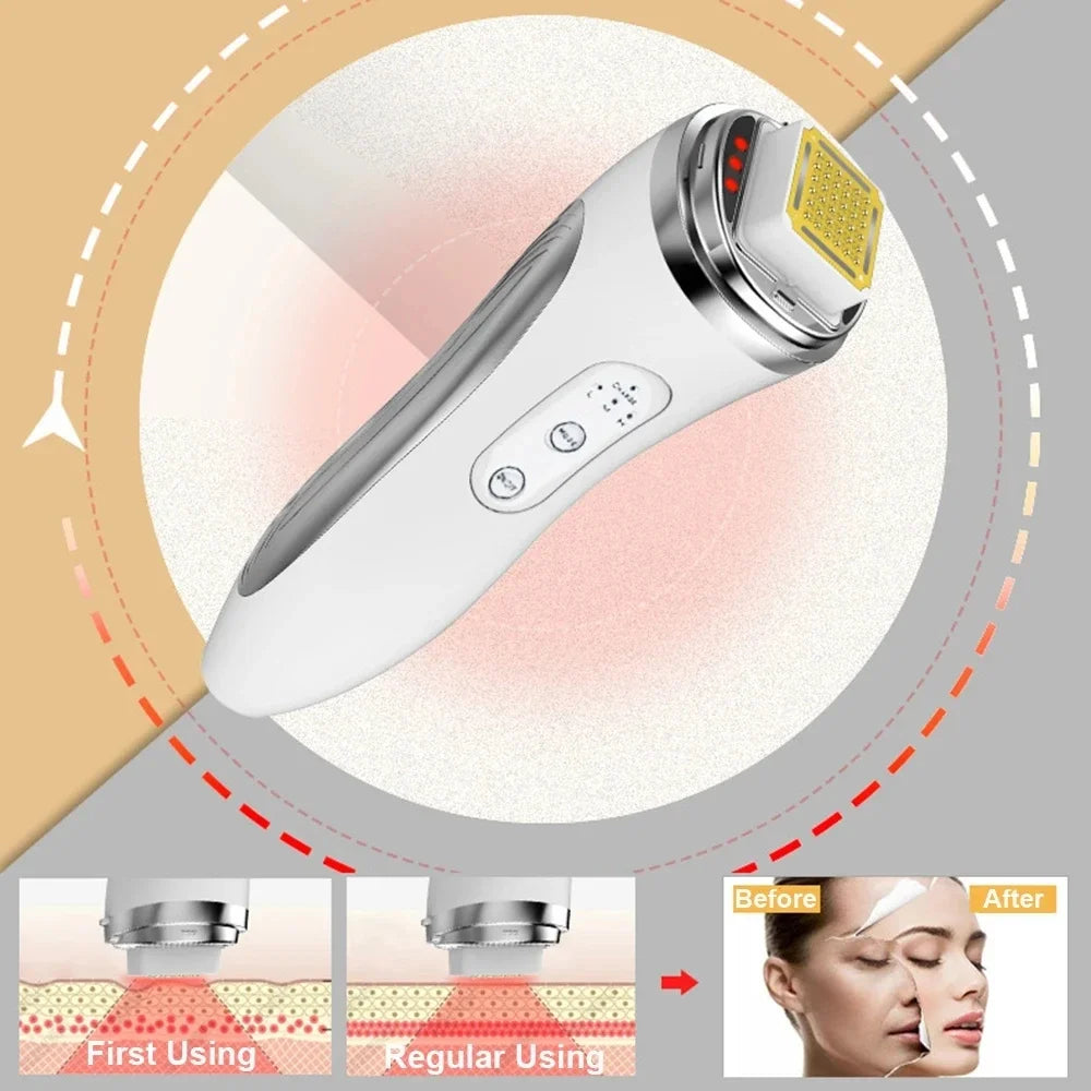 Radio Frequency Facial Lifting Machine, RF High Frequency Facial Care Massager