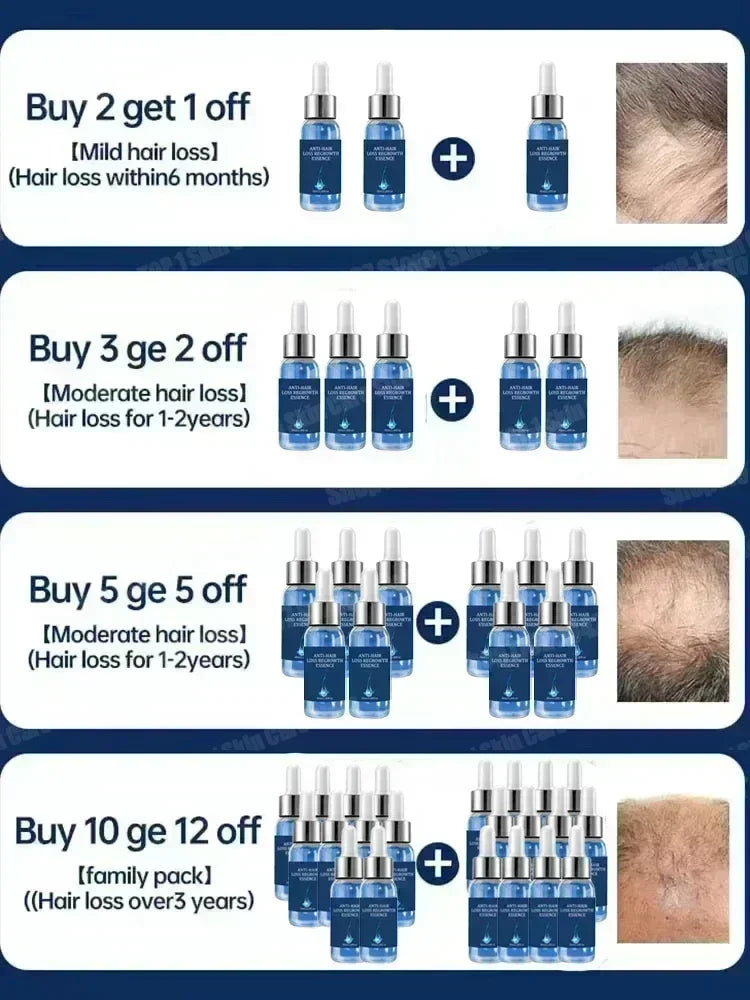 Hair growth and anti hair loss serum, anti hair loss scalp nutrition products