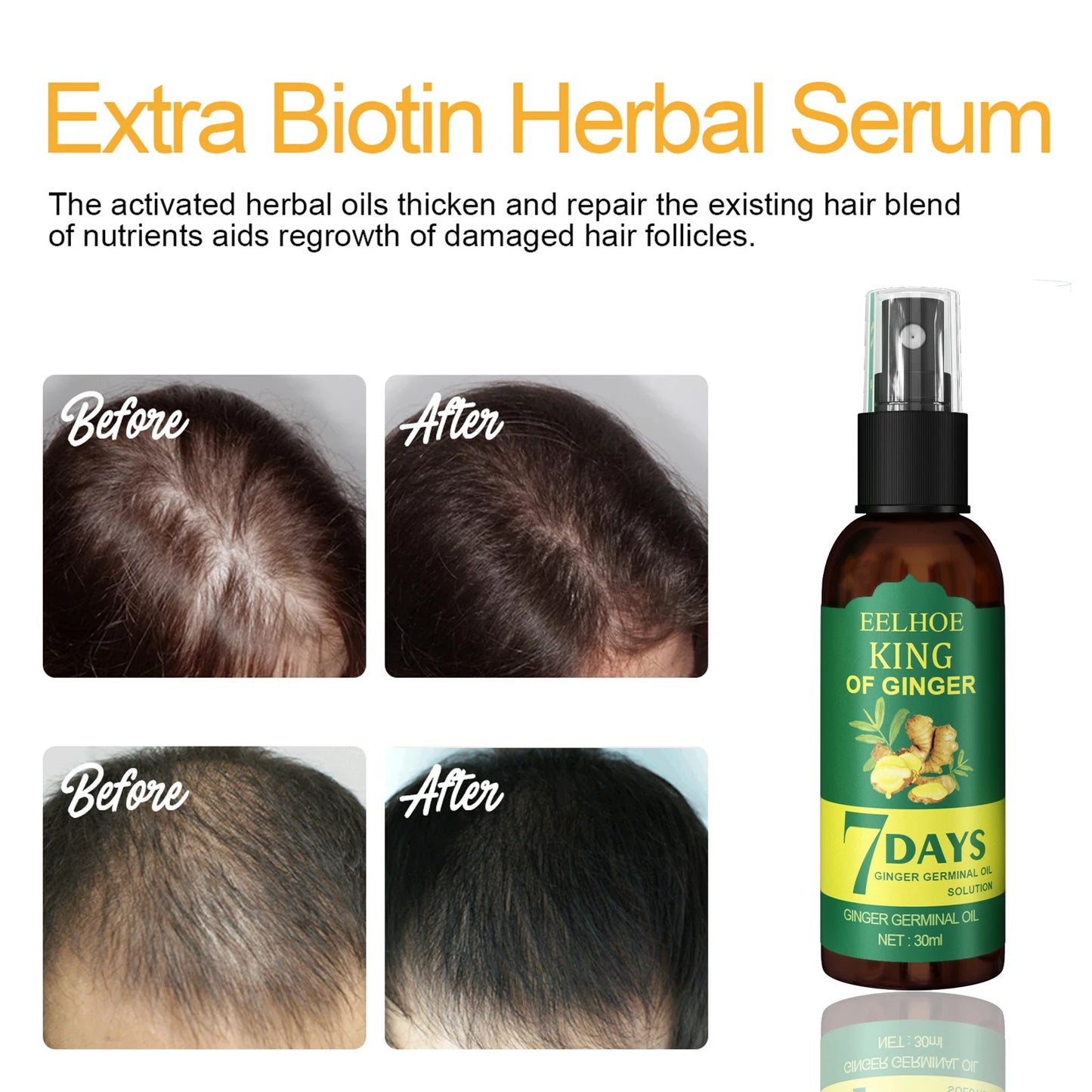 Ginger Care Hair Spray Hair Growth