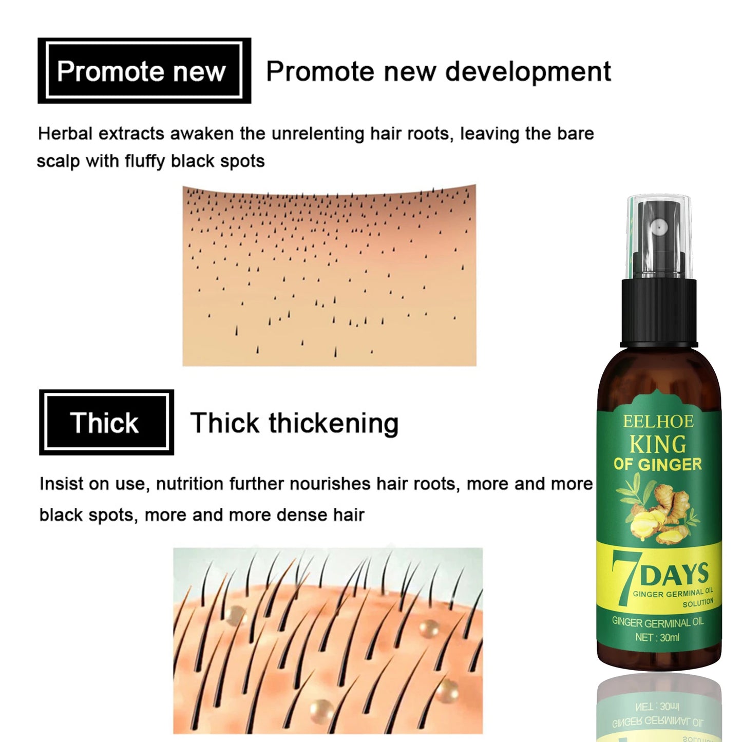 Ginger Care Hair Spray Hair Growth