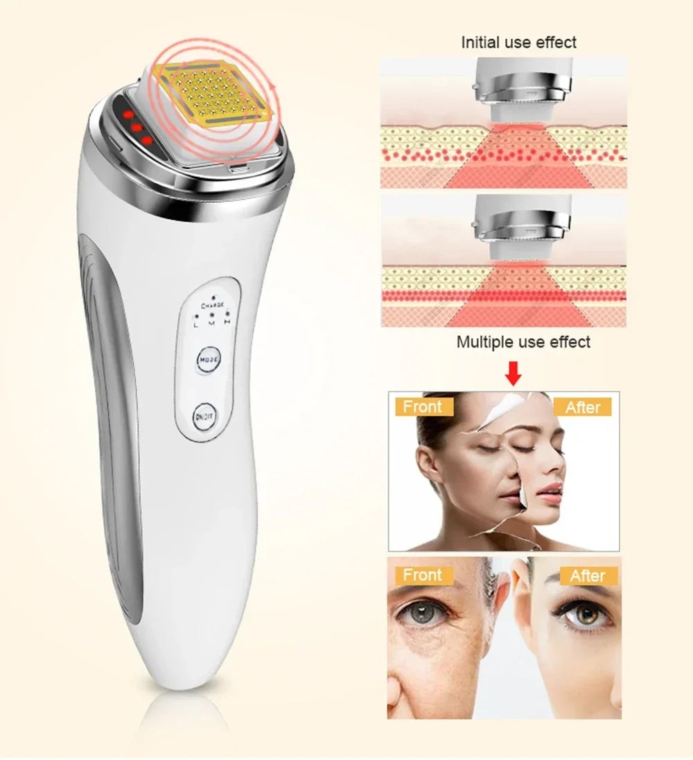 Radio Frequency Facial Lifting Machine, RF High Frequency Facial Care Massager